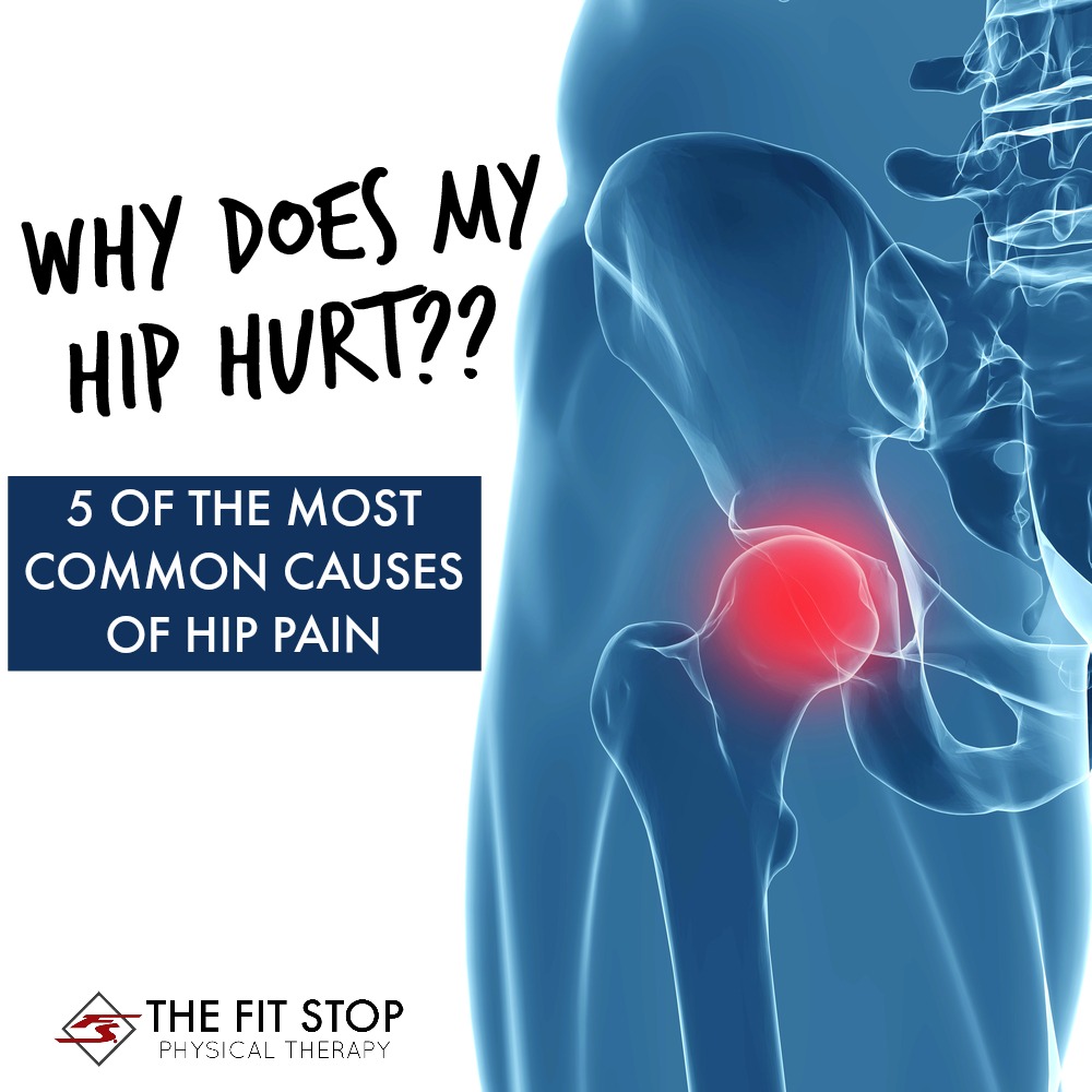 Diagnose Hip Pain Diagram